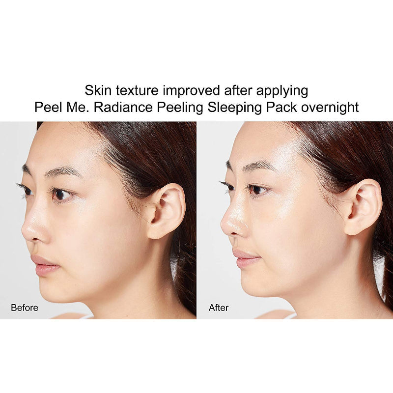 Radiance Peeling Sleeping Pack
