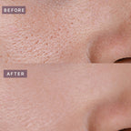 Pot Pore Tightening Podo Ampoule