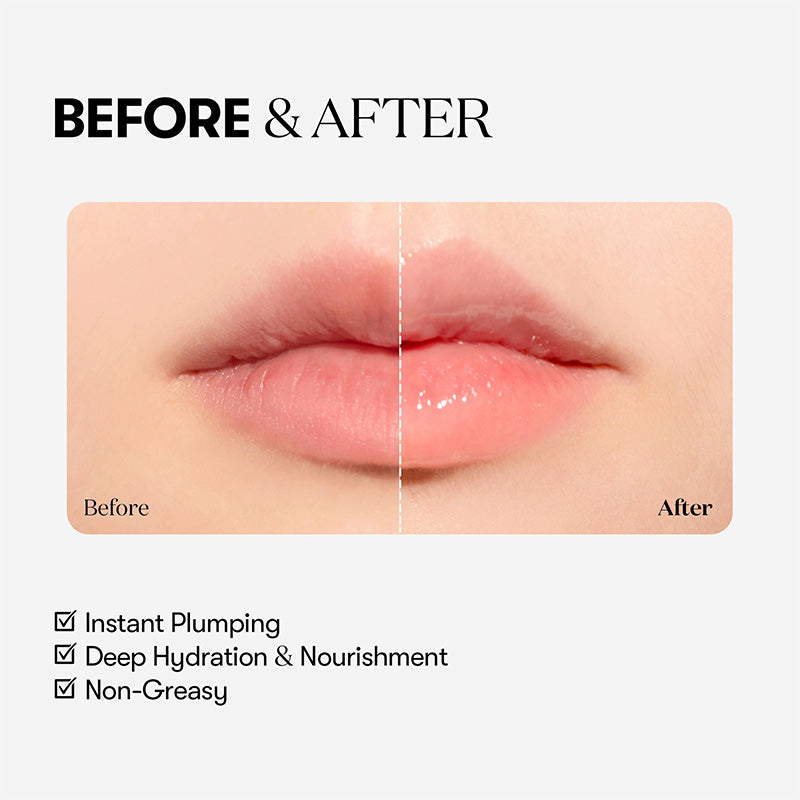 Reedle Shot Lip Plumper Beginner