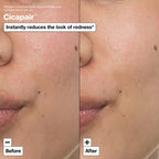 Cicapair™ Intensive Soothing Repair Cream